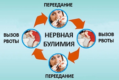 Лечение булимии в Васильевке